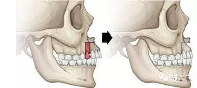 真实版整容日记！人生若只如初见，那时我还不好看