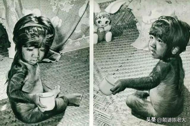 当年轰动一时的“毛孩”：42岁娶90后娇妻，生下一子未遗传长毛