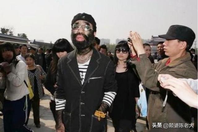当年轰动一时的“毛孩”：42岁娶90后娇妻，生下一子未遗传长毛