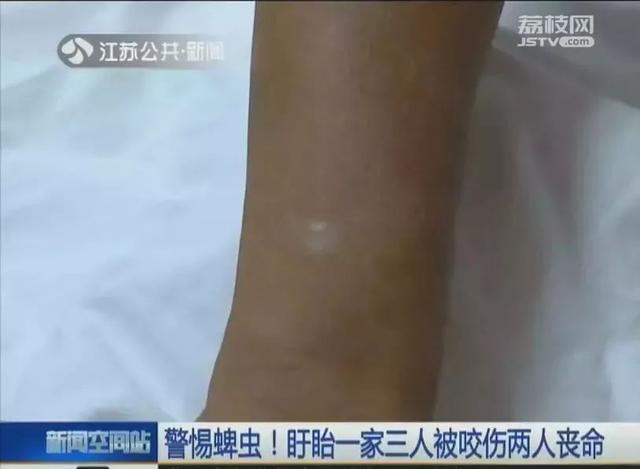 2岁娃眼皮上突然冒出一个小黑点！医生：这东西会要命！