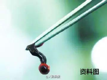 2岁娃眼皮上突然冒出一个小黑点！医生：这东西会要命！