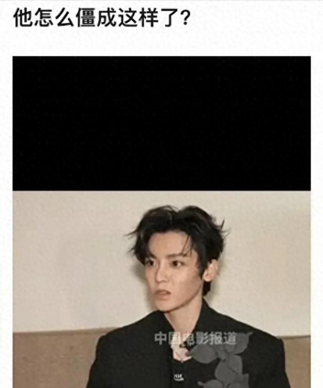 原来侯明昊早就整容!脸凹皮松挂不住肉,科技感太强
