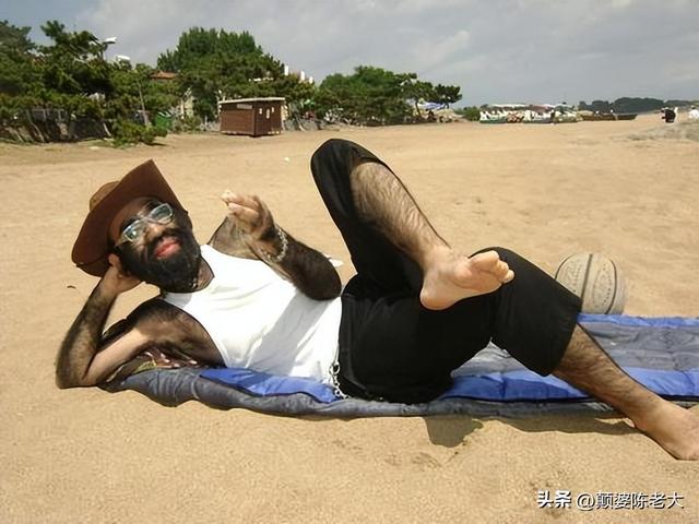 当年轰动一时的“毛孩”：42岁娶90后娇妻，生下一子未遗传长毛