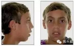 真实版整容日记！人生若只如初见，那时我还不好看