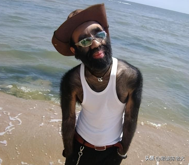 当年轰动一时的“毛孩”：42岁娶90后娇妻，生下一子未遗传长毛