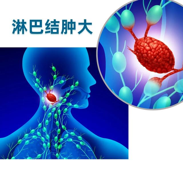 每天打呼噜，杭州男子确诊癌症！妻子崩溃：他不听我的呀