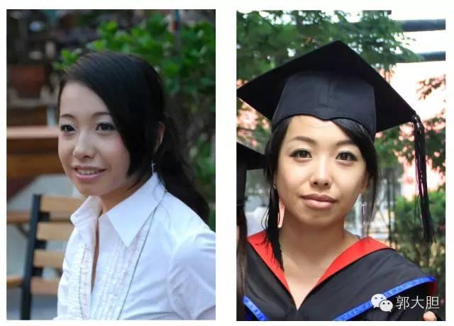 真实版整容日记！人生若只如初见，那时我还不好看