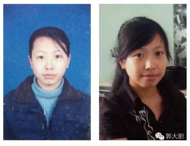 真实版整容日记！人生若只如初见，那时我还不好看