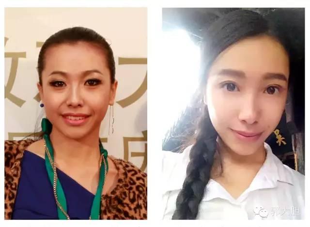 真实版整容日记！人生若只如初见，那时我还不好看