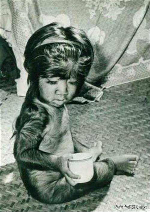 当年轰动一时的“毛孩”：42岁娶90后娇妻，生下一子未遗传长毛