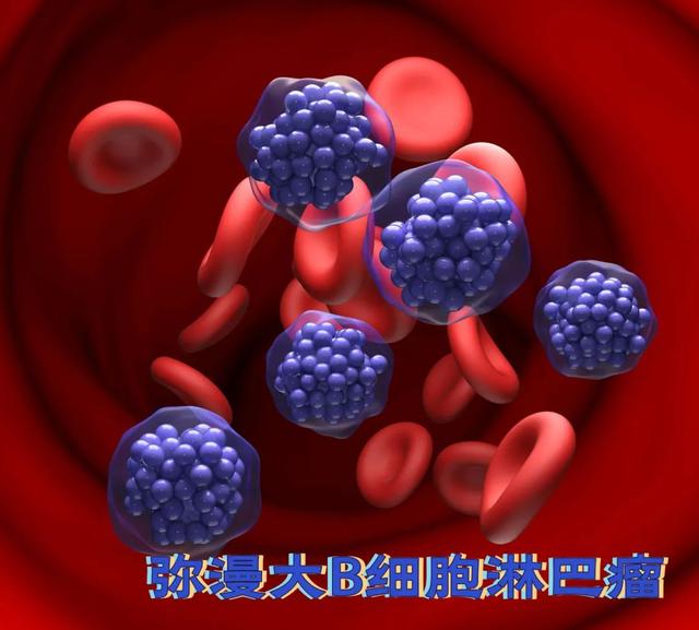 每天打呼噜，杭州男子确诊癌症！妻子崩溃：他不听我的呀