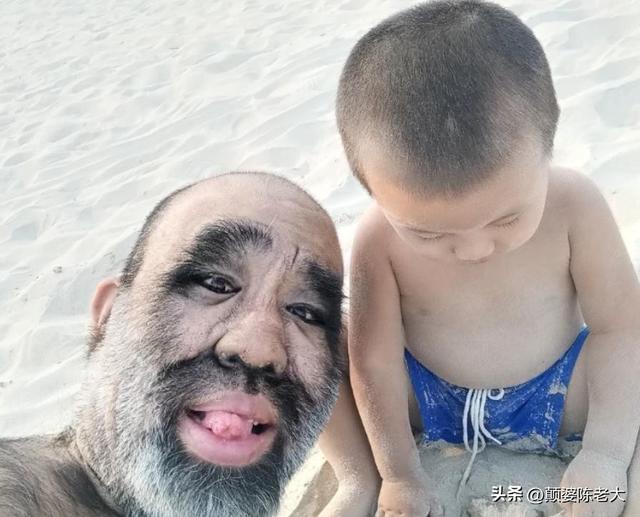 当年轰动一时的“毛孩”：42岁娶90后娇妻，生下一子未遗传长毛