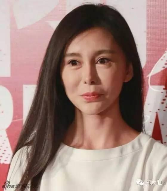 真实版整容日记！人生若只如初见，那时我还不好看