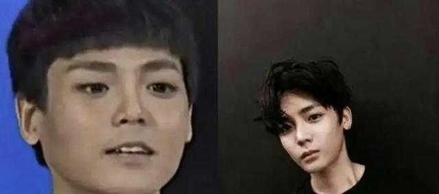 原来侯明昊早就整容!脸凹皮松挂不住肉,科技感太强