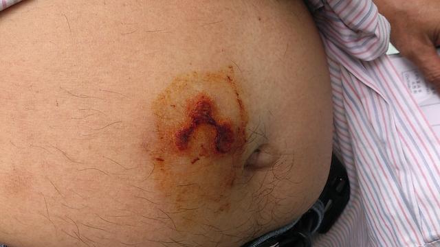 随处可见的臭屁虫，现在怎么消失了？云南人当美食吃到300元一斤