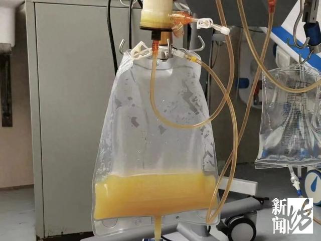 堪称“油王”!上海一男子突发剧烈腹痛,抽血抽出一袋油!罪魁祸首竟是它