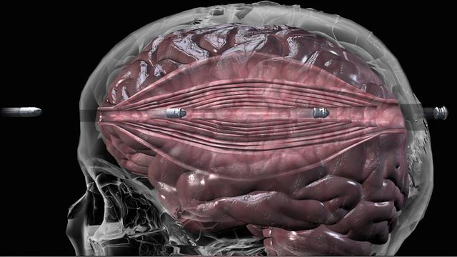 人体中枪之后，到底是一种什么感觉？为啥还有人说一点都不疼？