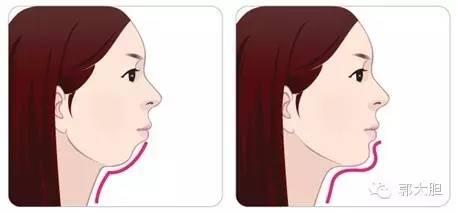 真实版整容日记！人生若只如初见，那时我还不好看