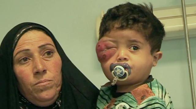 太惨了!“这就是种族灭绝!”