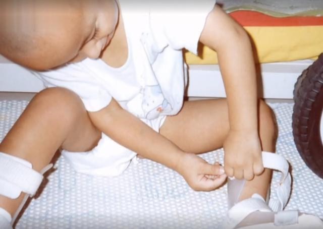 出生就是困难模式？少年先天脊柱裂，却逆天改命成最强大脑