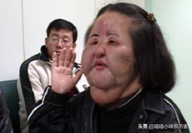 女星韩慧景：整容上瘾，往脸上注入7斤色拉油，面目全非太可惜