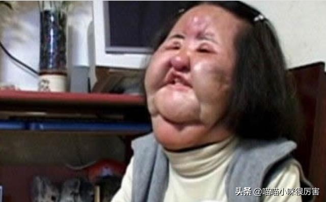 女星韩慧景：整容上瘾，往脸上注入7斤色拉油，面目全非太可惜