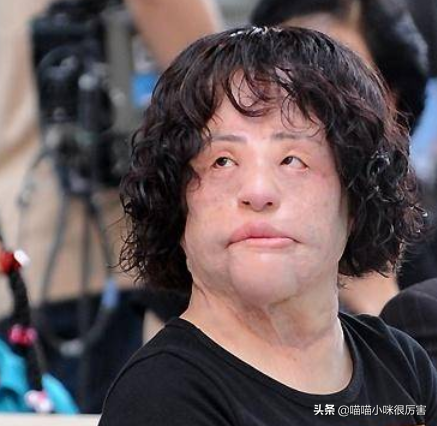 女星韩慧景：整容上瘾，往脸上注入7斤色拉油，面目全非太可惜