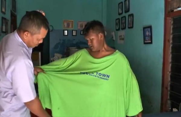 世界上最胖的男孩，380斤的体重如今已经减掉一半，变得帅多了