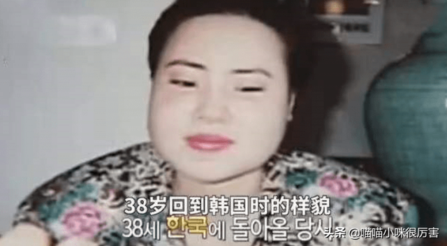 女星韩慧景：整容上瘾，往脸上注入7斤色拉油，面目全非太可惜