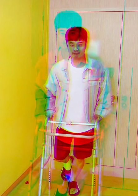 35岁陈赫手术后顺利出院！单腿蹦跳显滑稽，胡子拉碴脸消瘦不少