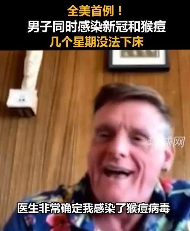 超1.6万例！美国一男子同时感染猴痘和新冠！“双倍痛苦，几乎不能下床”