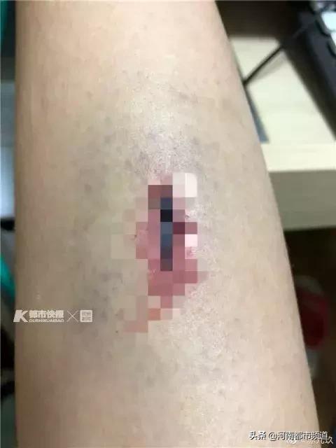 骑自行车被撞伤，对方还逃逸！知名美女舞蹈博主痛斥外卖小哥