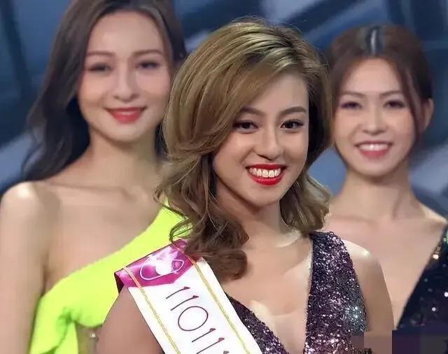 2022年香港小姐冠亚季军三个两个龅牙，大家都不要去整牙了