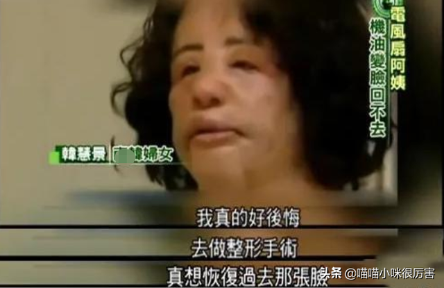 女星韩慧景：整容上瘾，往脸上注入7斤色拉油，面目全非太可惜