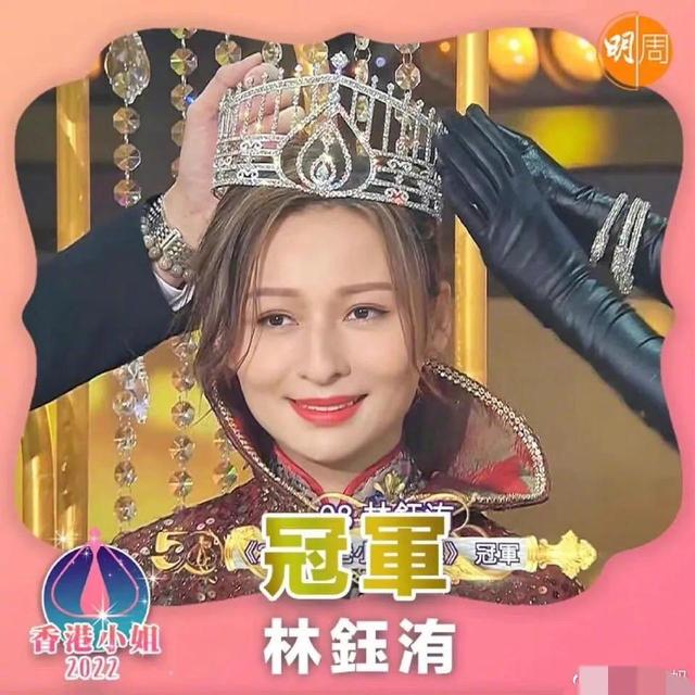 2022年香港小姐冠亚季军三个两个龅牙，大家都不要去整牙了