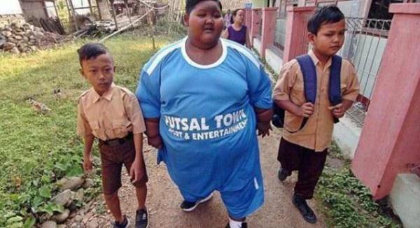 世界上最胖的男孩，380斤的体重如今已经减掉一半，变得帅多了