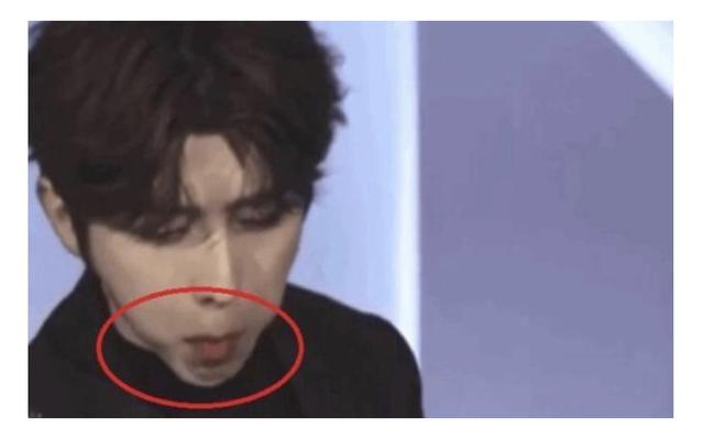 蔡徐坤颜值也崩了？下巴外翻角度显奇怪，线条诡异被指撞脸刘梓晨