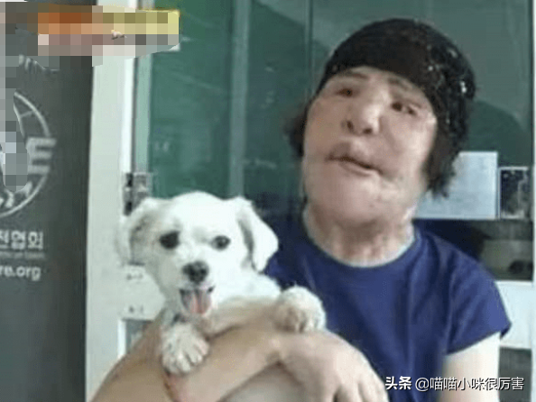 女星韩慧景：整容上瘾，往脸上注入7斤色拉油，面目全非太可惜