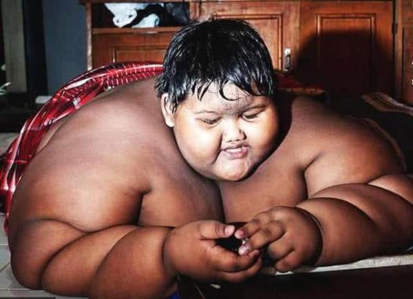 世界上最胖的男孩，380斤的体重如今已经减掉一半，变得帅多了