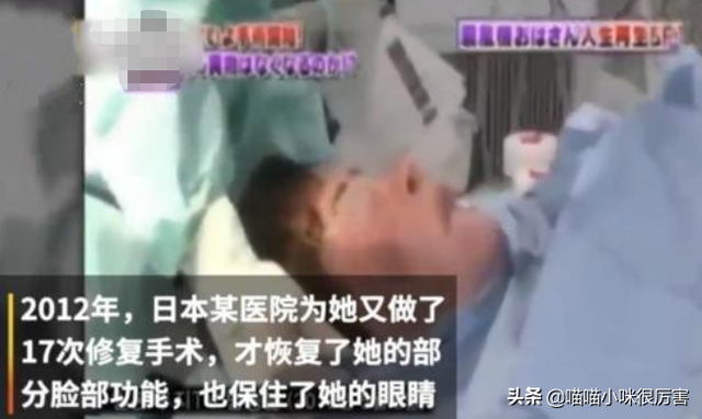 女星韩慧景：整容上瘾，往脸上注入7斤色拉油，面目全非太可惜