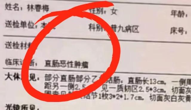 贵州美女模特“春梅”去世！年仅29岁，化疗18次，因月经不调确诊