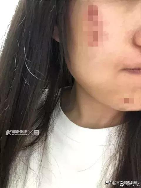 骑自行车被撞伤，对方还逃逸！知名美女舞蹈博主痛斥外卖小哥