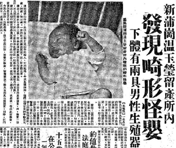 公园草丛发现灰肤大头怪婴，大头、无生殖器官，吓坏旁人