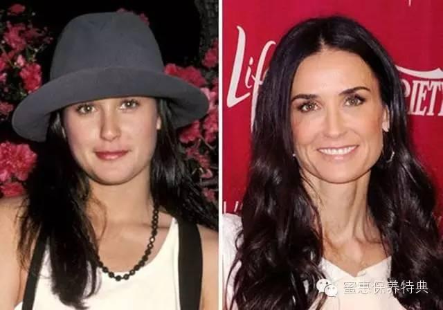 欧美阿姨PK日本大妈——差了10斤胶原蛋白！