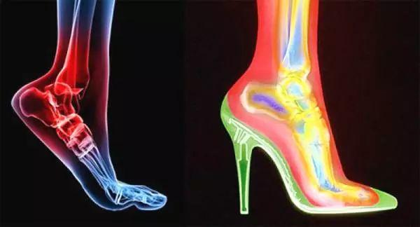 拖鞋要带点跟才好看