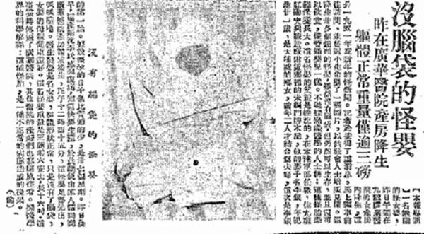 公园草丛发现灰肤大头怪婴，大头、无生殖器官，吓坏旁人