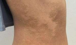 痒 女主播(年轻女主播全身脱皮、奇痒不止只因24小时都在…紧急提醒)