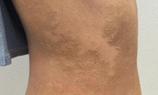 年轻女主播全身脱皮、奇痒不止！只因24小时都在…紧急提醒！