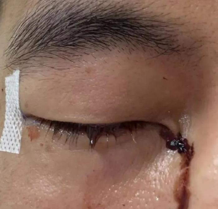 郭艾伦发声:这口气咽不下去