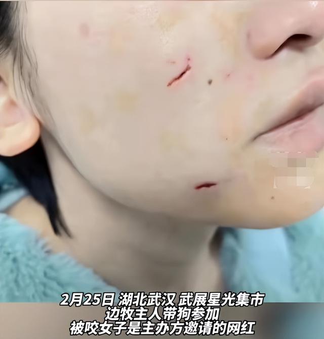 女网红强行撸狗被咬伤,事后要求狗主人赔偿,狗不懂事人也不懂吗